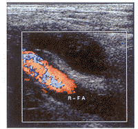 ��������ѹ�չɶ������Զ�����1��