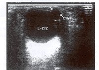 ��Ƶ̽ͷ̽���Ĥ����1��