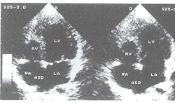 �����ҷ�����ȫ�ϲ��̷��׷����ȱ��ͼ����Ҽ��ȱ��1��