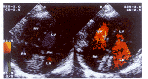 ���������⾭Ƥ���̱պϼ̷��׷����ȱ��2��