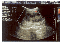 ��ͯ����޴����Լ���1��