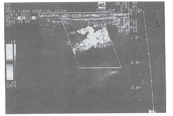 ��ɫ�������Ǽ��𸹹ɹ�б�޼�ֱ�޵ļ�Ҫ����