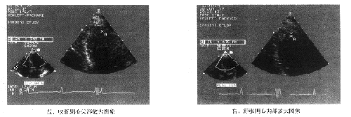 �����ļⲿ����ѧ���������쳣�˶������2-D�����Ķ�ͼ�۲�