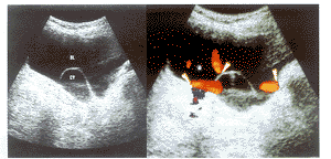 ��������׵���ά�����Ͳ�ɫ���������