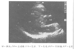 ����������������ά�������Ķ�ͼ���ٴ����ַ���