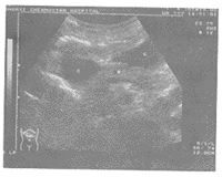 B�������������1��