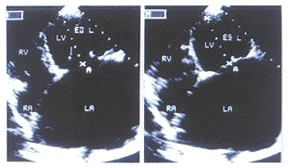 �������۶�����û����г��������½ṹ�����������Ҽ�����̬��Ӱ��