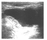 �����ڼױ����ж��İ�������ͼ����