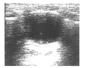 �����ڼױ����ж��İ�������ͼ����