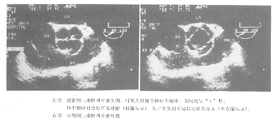 ���ؼ�����ƽ��ʳ�ܳ��������������������Ҷ�����