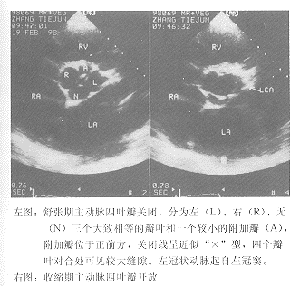 ���ؼ�����ƽ��ʳ�ܳ��������������������Ҷ�����