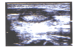 �����Գ����ڼ�״�ټ�����Ϻ������е�Ӧ��