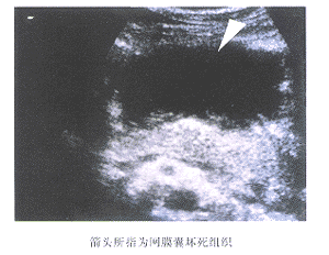 ����������ʱ�����۲���Ĥ�Ҳ����׼ȷ�Լ��ٴ�����