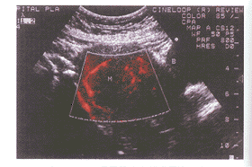 ��ɫ�����������������ӹ�������Ѫ����Ӧ�ü�ֵ