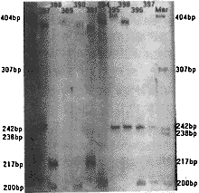 �����-Լɪ��/����С���͹���ʧ�����ͻ���(CAG)n���������ٴ�����<sup>��</sup>