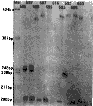 �����-Լɪ��/����С���͹���ʧ�����ͻ���(CAG)n���������ٴ�����<sup>��</sup>