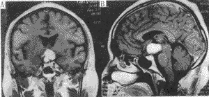 �ӽ���-�����Խ����������������