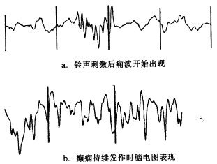 ��Ϣ����ȱѪ������Դ�����ģ�͵�ʵ���о�<sup>��</sup>