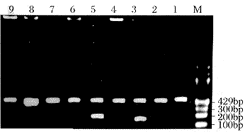 PCR-SSP෢ӲHLA-DRB1λٴӦ̽