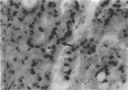 ��ֱ������ǰ��������ע���ƶ�����ϸ����������ϸ������-1��-ת��ø�����Ӱ��