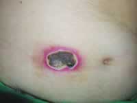 5��Ƥ����������ע����Ҷ��������ئ�-2b���//