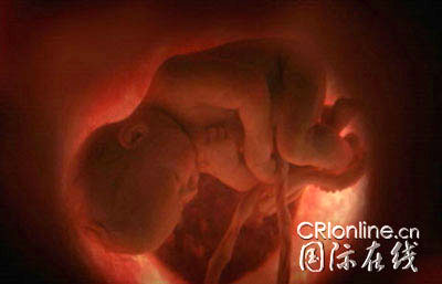 ̥�����ӹ���˯��(��ͼ)��//