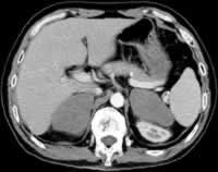 �����ϸ����ʡ�˫��������ռλ