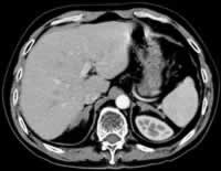 �����ϸ����ʡ�˫��������ռλ