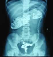 ��ͯ�᳦��