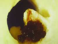 ���㱣�����Ѫ�ܱ����ļ�������