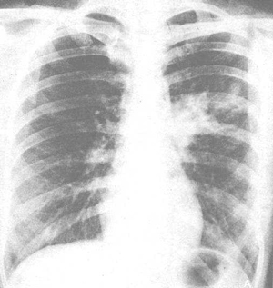 ֧ԭ����׵�Ӱ��ѧ����