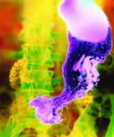 ASCO����2005�������ٴ��о�ʮһ���չ