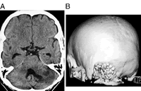 һ�ּ򵥶���ȫ��­���ؽ�����