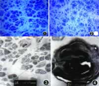 ��Χ�񾭻�����������CIDP