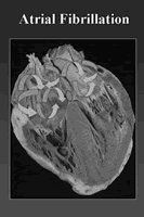 �ڷ�����ͪ�ɽ������󷿲�����Σ��