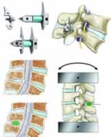 ��ͻ���ѹϵͳ��������׵׵����խ֢״