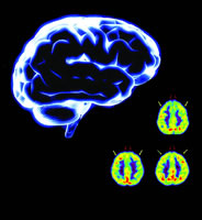 ���ٰ����ƿ���Ӱ���Թ���