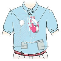 �Ŵ��Խ�ֱ������ɸ��  �조�ա���ɫ������