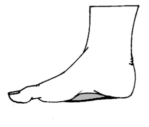 �Ÿ�ʹ���˿����ԽŸ�Ь��