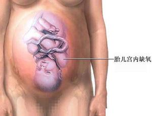 �ʸ���������ɫͼ����˵