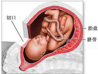 �ʸ���������ɫͼ����˵