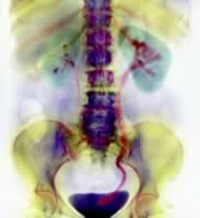 ҩ�����ƿɴ�ʹ�������ʯ�ų�