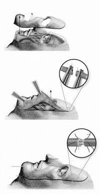 ����ȫ����ֲ������Ӣ����