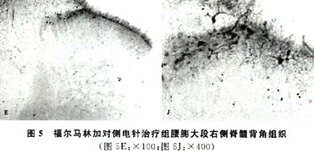 ���롰������Դ����豳���ڣţңˣ��������ữˮƽ��Ӱ��