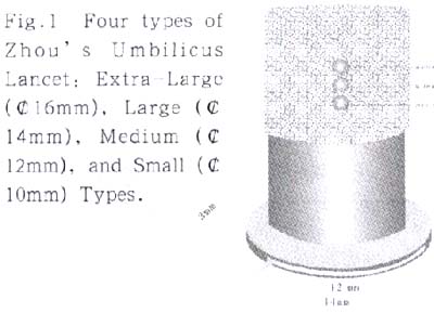 ���ǻ����β�г����о���չ