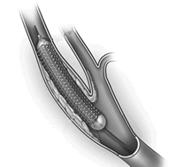 �������ӹ���֧�����������խ��