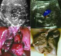 �����Ķ�ͼ׼ȷ���̥�����Ĳ�