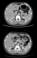 Ѫѹ���ߡ������졢������ռλ