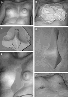 �轺��������©�����ؽ���