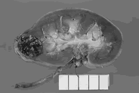 UVB��¶���� ����Σ������